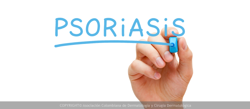 psoriasis4